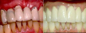 Periodontics copy